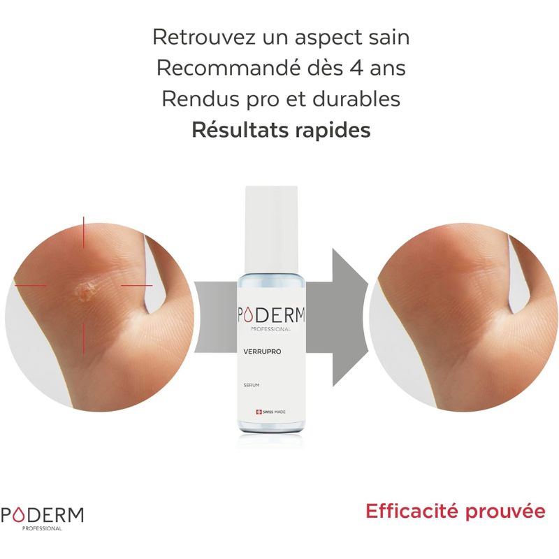 Solution Pieds-Mains Sérum Verrupro 6ml | Anti-verrues