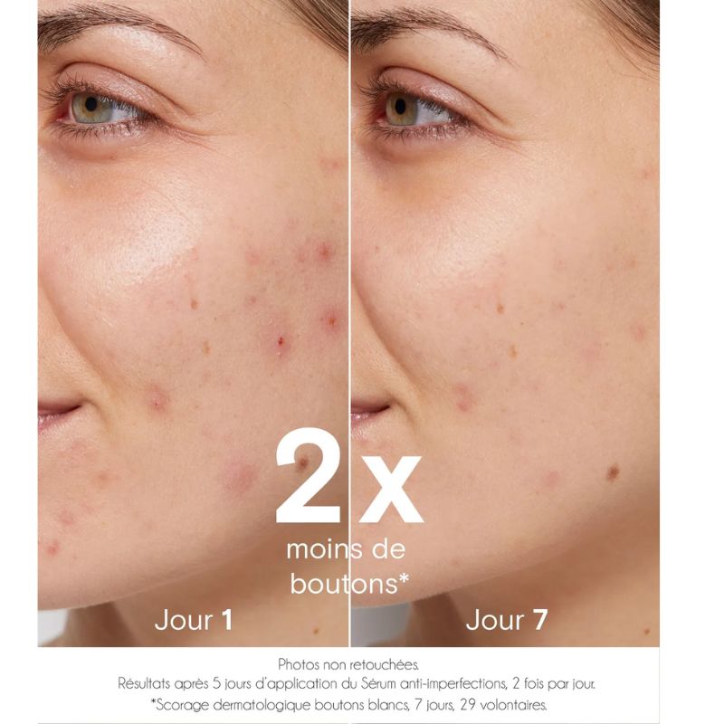 Sérum purifiant Anti-imperfections 30ml | Zinc et Acides de fruits BIO