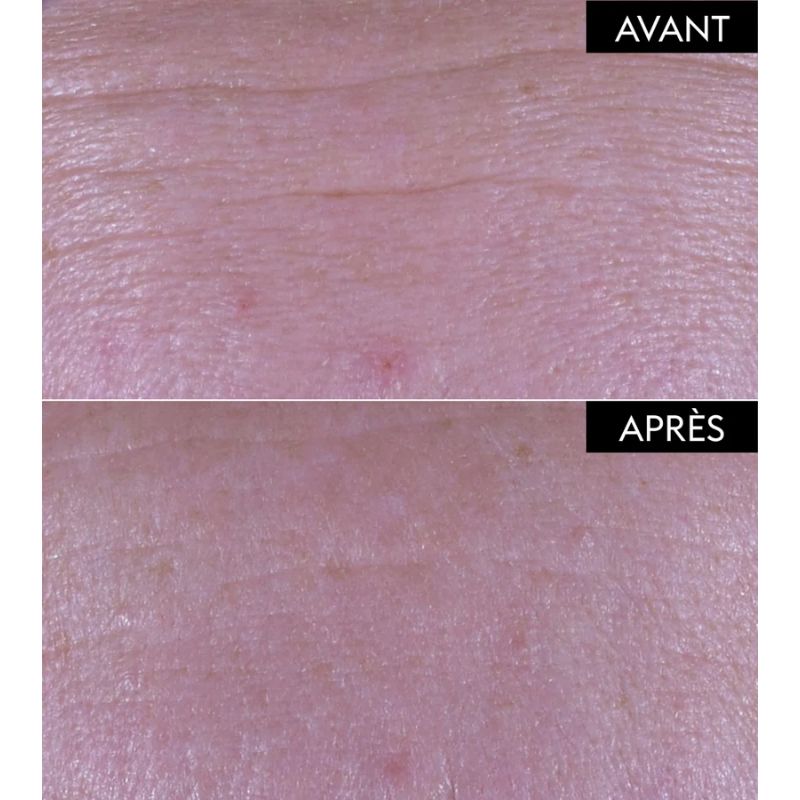 Sérum Repulpant Fondamental 30 ml