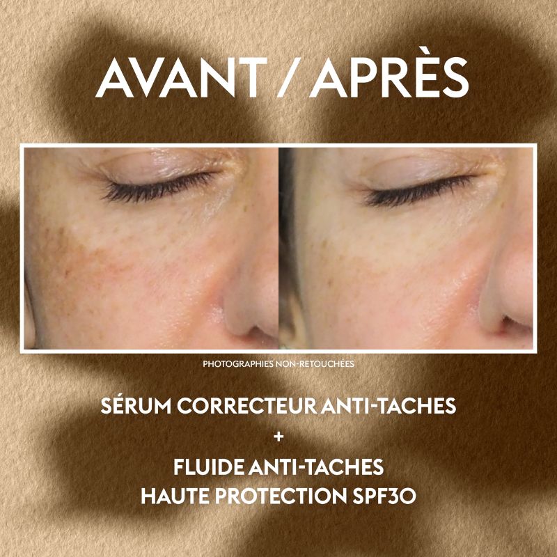 Coffret Duo Anti-Taches | Sérum Anti-Taches 30 ml + Fluide Anti-Taches Offert