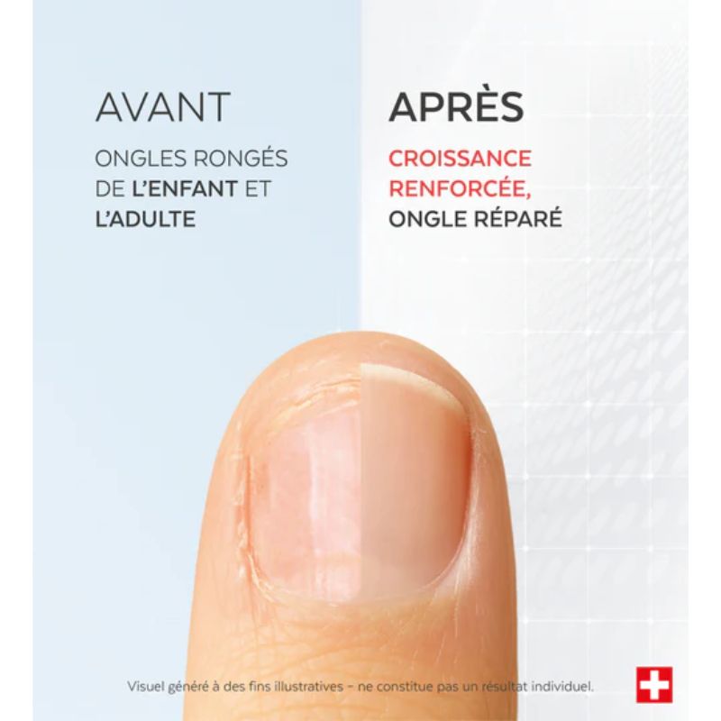 Sérum Ongles Rongés 8ml | Répare, fortifie, embellit