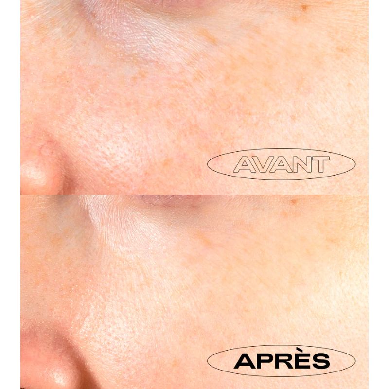 Anti-Taches Perfect | Peeling Nuit Rénovateur Éclat 50ml