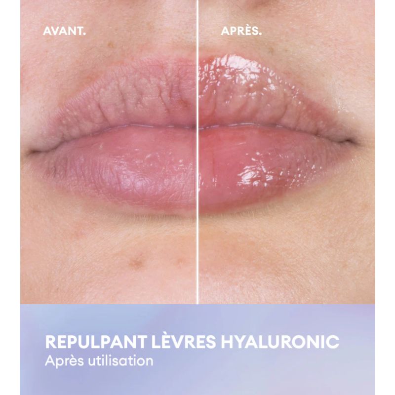 Age Specific Intensif | Repulpant Lèvres Hyaluronic 7ml