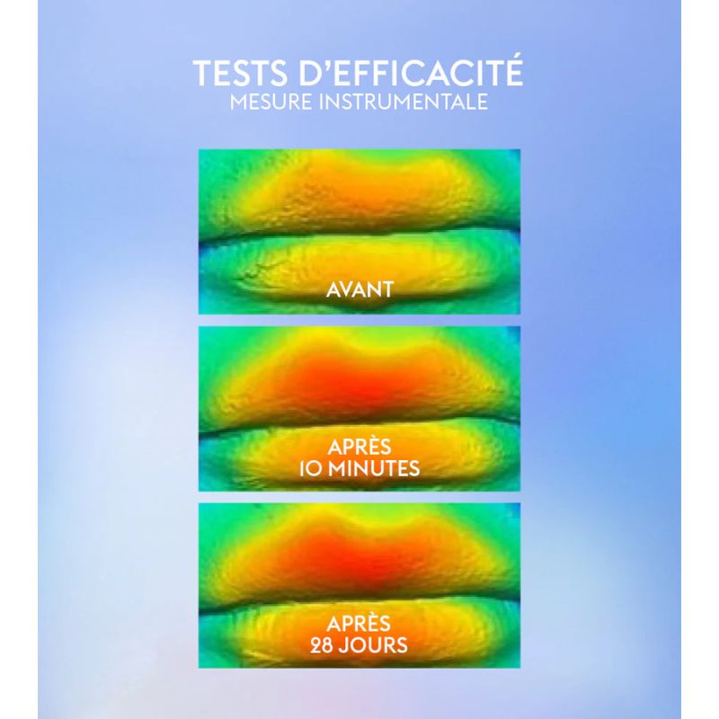 Age Specific Intensif | Repulpant Lèvres Hyaluronic 7ml